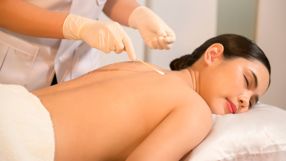 What is Acupuncture?    